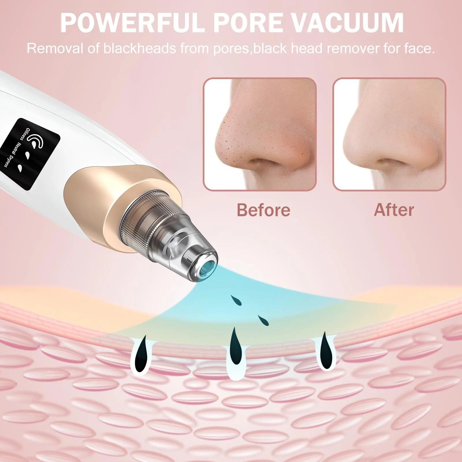 Blackhead Remover Pore Vacuum Kit - 2023 Upgraded Blackhead Extractor Tool with 3 Adjustable Suction Levels, 5 Probes, USB Rechargeable, Suitable for Women and Men